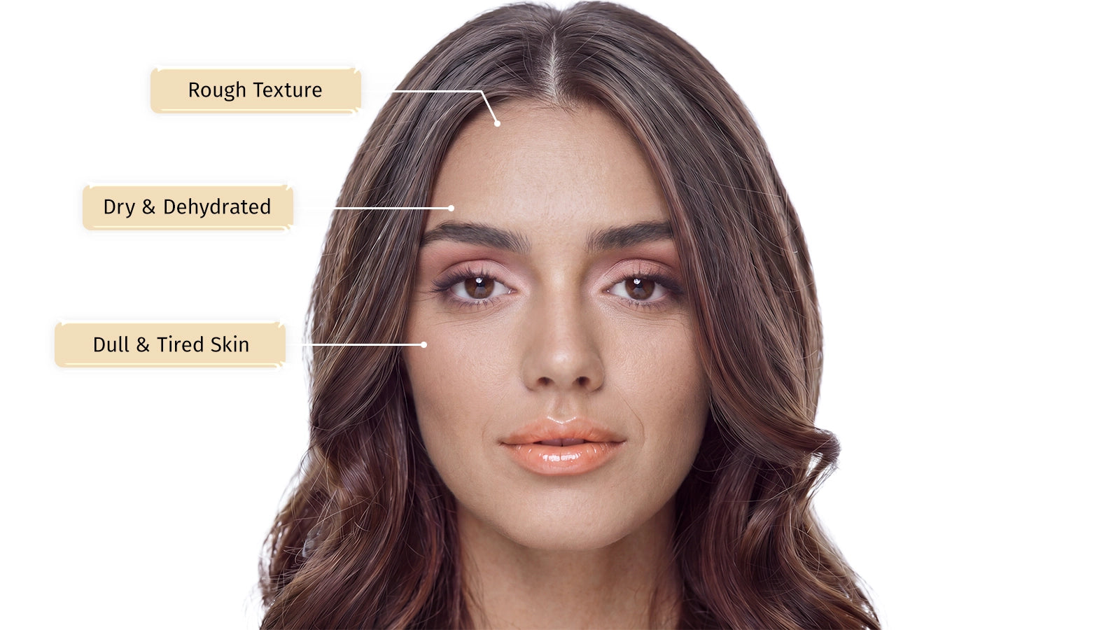 Woman's face with text labels on skin conditions on a white background